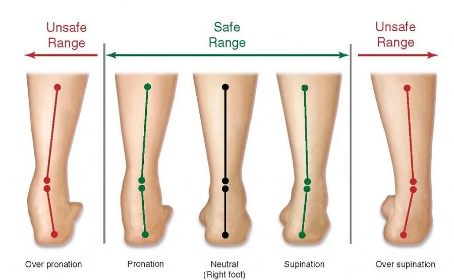 How Motion Control Shoes Counteract Overpronation