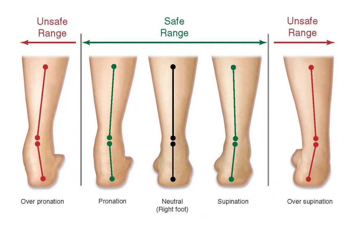 Understanding Your Foot Arch and Pronation
