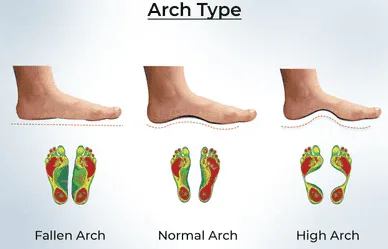 Who Needs Shoe Insoles and Why?