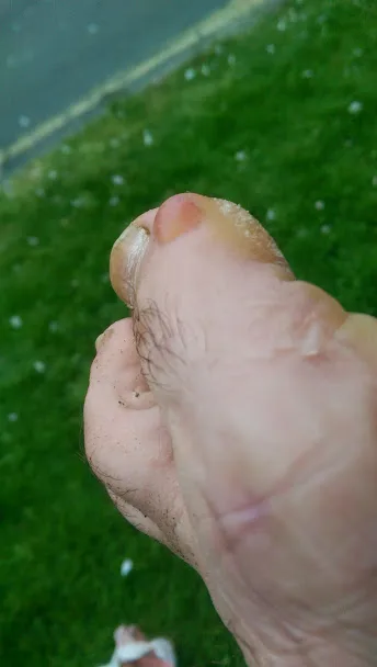 why do trail running shoes hurt my feet